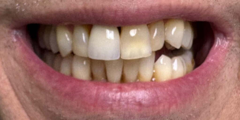 Before