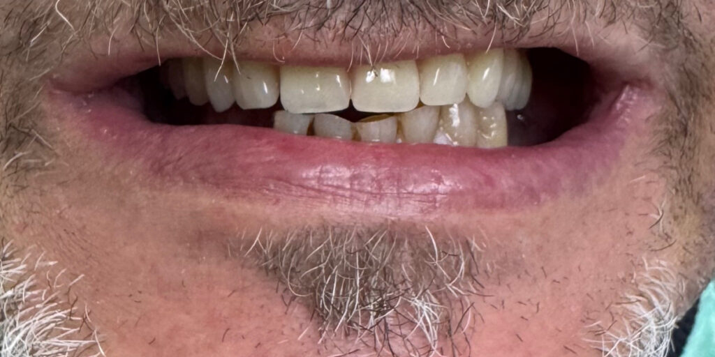 After